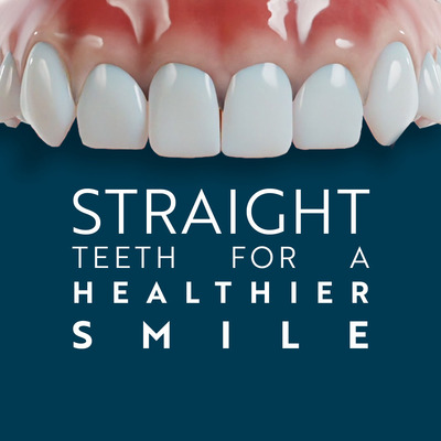 Straight Teeth for a Healthier Smile