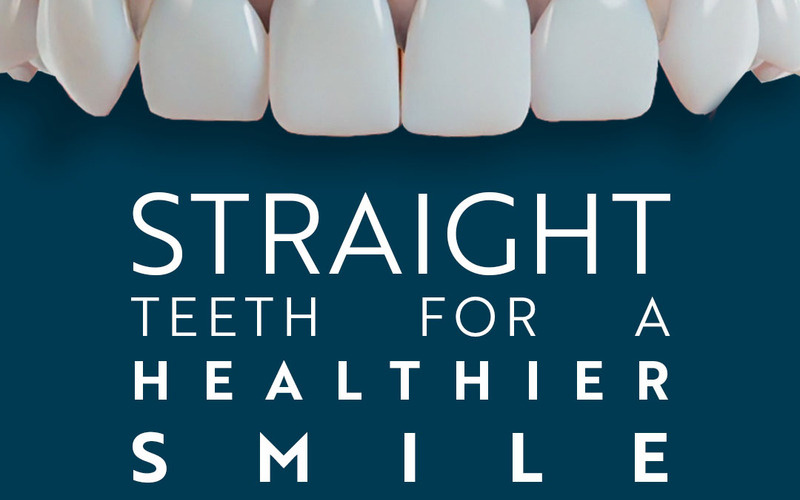 Straight Teeth for a Healthier Smile